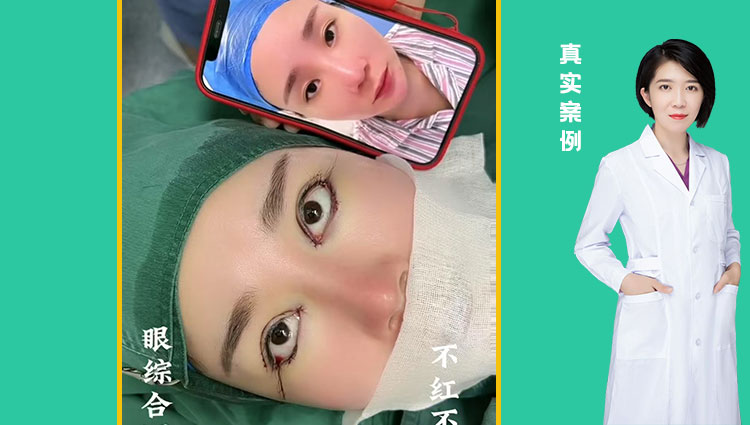 眼综合四项